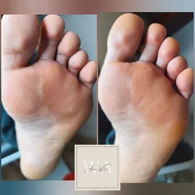 WA Podology & Nails Anna Witek